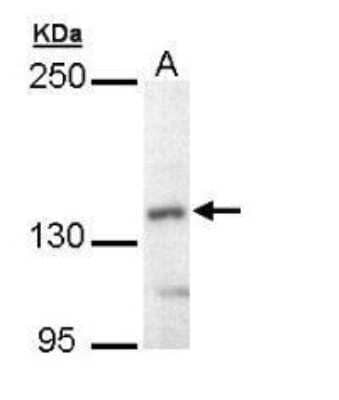 Western Blot: UBE4B Antibody [NBP1-32737]