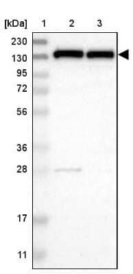Western Blot: UBE4B Antibody [NBP1-84943]