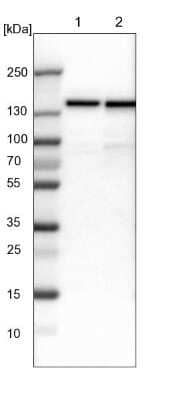 Western Blot: UBE4B Antibody [NBP1-84943]