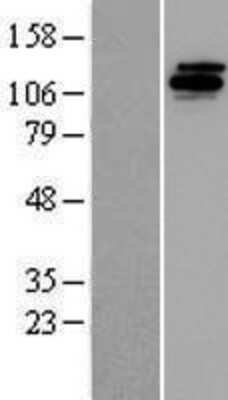 Western Blot: UBE4B Overexpression Lysate [NBP2-07677]