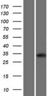 Western Blot: UBFD1 Overexpression Lysate [NBP2-06717]