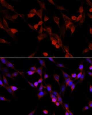 Immunocytochemistry/ Immunofluorescence: UBIAD1 Antibody - BSA Free [NBP2-93542]