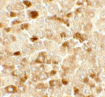 Immunohistochemistry: UBIAD1 Antibody - BSA Free [NBP2-82046]