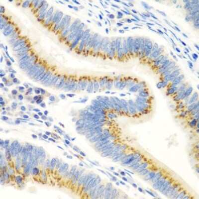 Immunohistochemistry-Paraffin: UBIAD1 Antibody - BSA Free [NBP2-93402]