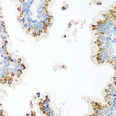 Immunohistochemistry-Paraffin: UBIAD1 Antibody - BSA Free [NBP2-93402]