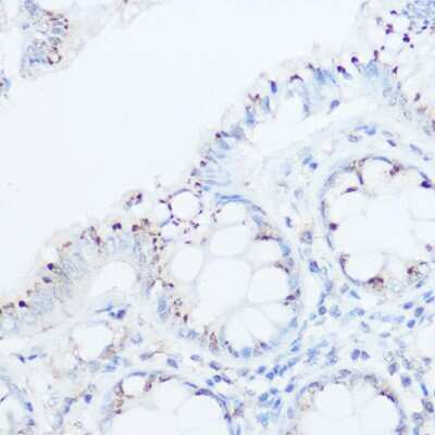 Immunohistochemistry-Paraffin: UBIAD1 Antibody - BSA Free [NBP2-93542]