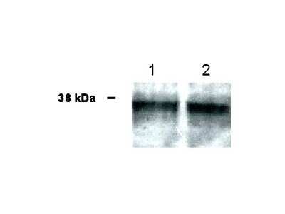 Western Blot: UBIAD1 AntibodyBSA Free [NB100-468]