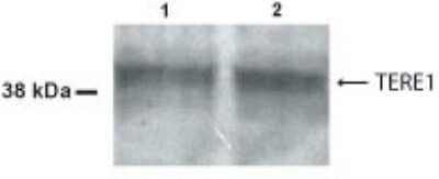 Western Blot: UBIAD1 AntibodyBSA Free [NB100-468]