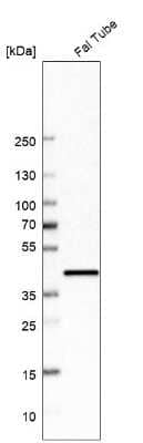 Western Blot: UBIAD1 Antibody [NBP2-55187]