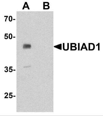 Western Blot: UBIAD1 AntibodyBSA Free [NBP2-82046]