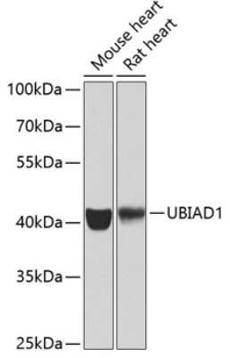 Western Blot: UBIAD1 AntibodyBSA Free [NBP2-93402]