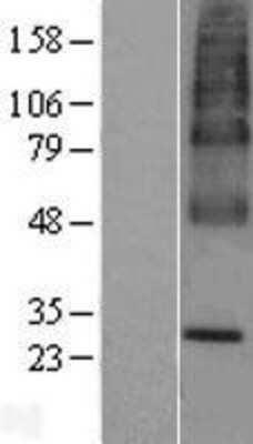 Western Blot: UBIAD1 Overexpression Lysate [NBP2-07426]