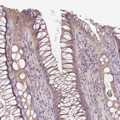 Immunohistochemistry-Paraffin: UBL3 Antibody [NBP2-31566]