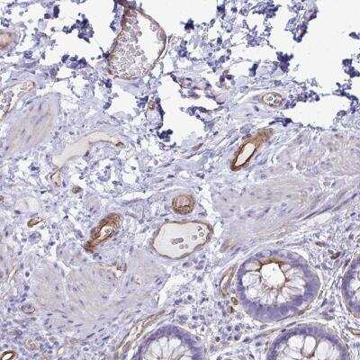 Immunohistochemistry-Paraffin: UBL3 Antibody [NBP2-31730]