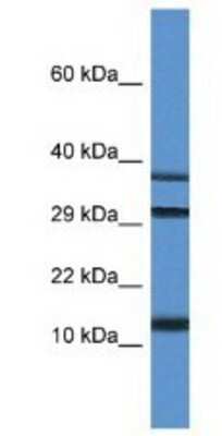 Western Blot: UBL3 Antibody [NBP1-74174]