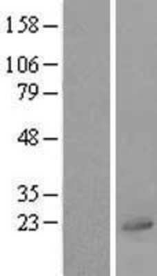 Western Blot: UBL4A Overexpression Lysate [NBL1-17554]