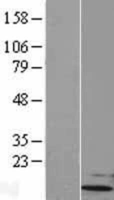 Western Blot: UBL5 Overexpression Lysate [NBL1-17555]