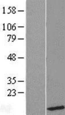 Western Blot: UBL5 Overexpression Lysate [NBL1-17556]