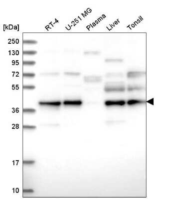 Western Blot: UBL7 Antibody [NBP2-58983]