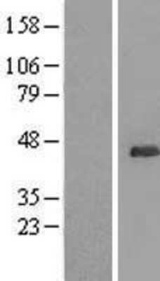 Western Blot: UBL7 Overexpression Lysate [NBL1-17557]