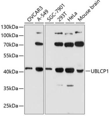 Western Blot: UBLCP1 AntibodyAzide and BSA Free [NBP2-94630]