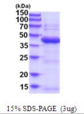 SDS-PAGE: Recombinant Human UBLCP1 His Protein [NBP2-52067]