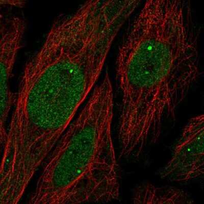 Immunocytochemistry/ Immunofluorescence: UBN1 Antibody [NBP2-57252]