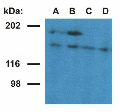 Western Blot: UBN1 Antibody (UBN1-02) [NBP2-62205]