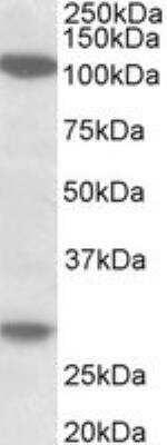 Western Blot: UBN1 Antibody [NBP2-26142]