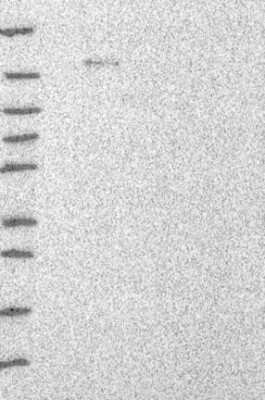 Western Blot: UBN1 Antibody [NBP3-17956]