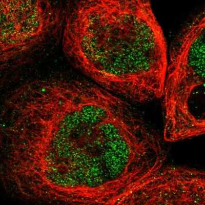 Immunocytochemistry/ Immunofluorescence: UBN2 Antibody [NBP1-93902]