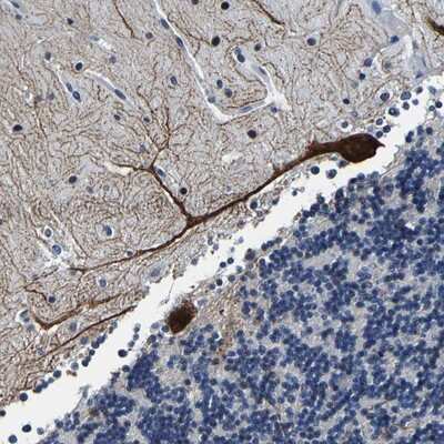 Immunohistochemistry-Paraffin: UBN2 Antibody [NBP1-93904]