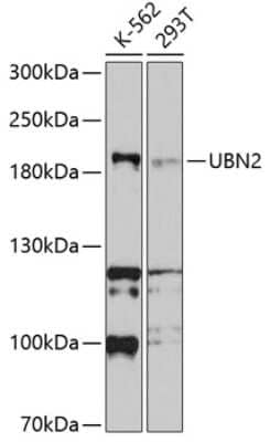 Western Blot: UBN2 AntibodyBSA Free [NBP2-94169]