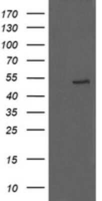 Western Blot: UBOX5 Antibody (OTI8D5) [NBP2-46287]