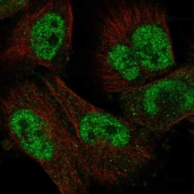 Immunocytochemistry/ Immunofluorescence: UBOX5 Antibody [NBP1-81469]