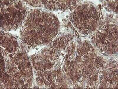 Immunohistochemistry: UBOX5 Antibody (OTI1C5) - Azide and BSA Free [NBP2-74760]