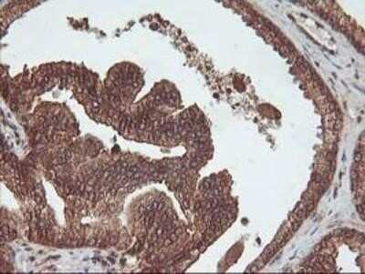 Immunohistochemistry: UBOX5 Antibody (OTI1C5) - Azide and BSA Free [NBP2-74760]