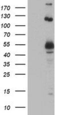 Western Blot: UBOX5 Antibody (OTI1C5)Azide and BSA Free [NBP2-74760]