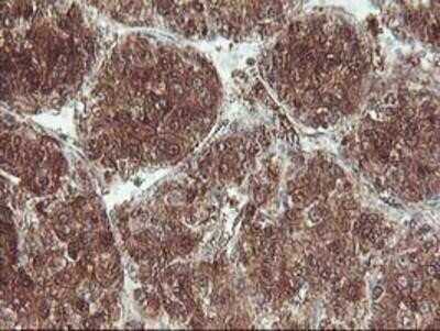 Immunohistochemistry-Paraffin: UBOX5 Antibody (OTI1C5) [NBP2-01077]