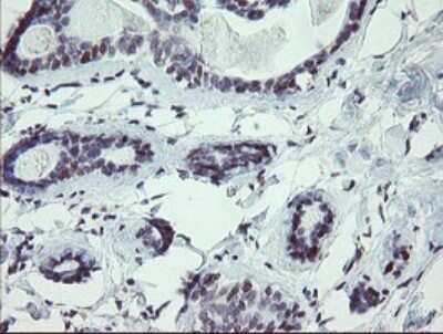 Immunohistochemistry: UBOX5 Antibody (OTI8D5) - Azide and BSA Free [NBP2-74757]