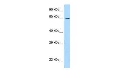 Western Blot: UBOX5 Antibody [NBP2-88538]