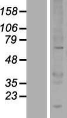 Western Blot: UBOX5 Overexpression Lysate [NBL1-17560]