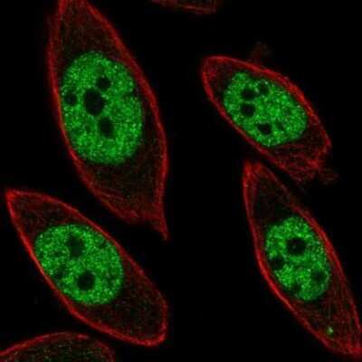 Immunocytochemistry/ Immunofluorescence: UBP1 Antibody [NBP1-82842]