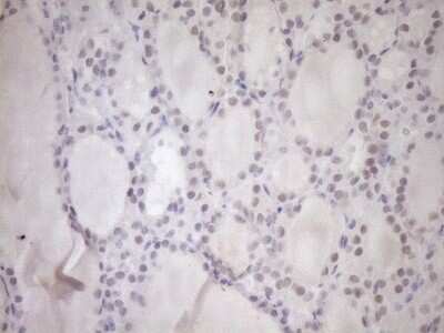 Immunohistochemistry: UBP1 Antibody (OTI9G7) - Azide and BSA Free [NBP2-74761]