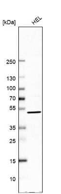Western Blot: UBP1 Antibody [NBP1-82842]