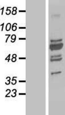 Western Blot: UBP1 Overexpression Lysate [NBL1-17561]