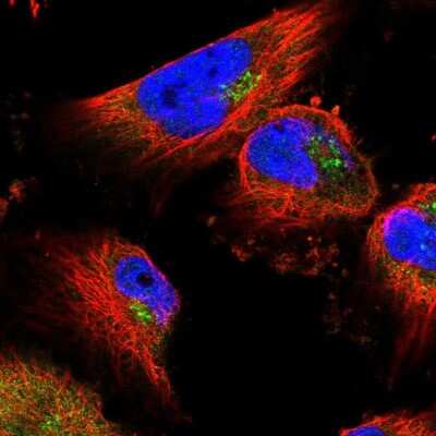 Immunocytochemistry/ Immunofluorescence: UBPY/USP8 Antibody [NBP2-55627]