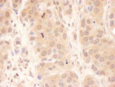 Immunohistochemistry-Paraffin: UBPY/USP8 Antibody [NBP1-50001]
