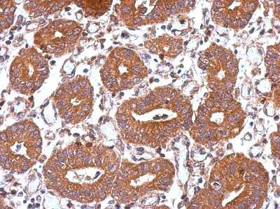 Immunohistochemistry-Paraffin: UBPY/USP8 Antibody [NBP2-20792]