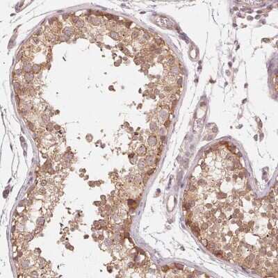 Immunohistochemistry-Paraffin: UBPY/USP8 Antibody [NBP2-55627]